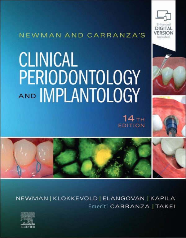 Newman and Carranza's Clinical Periodontology and Implantology 14th Edition